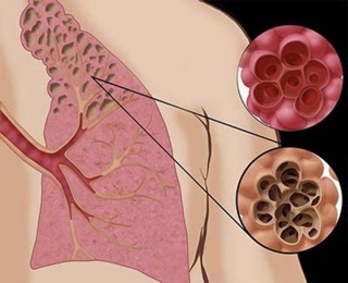Тест "Дыхательная система человека"; 8 класс (.docx) thumbnail