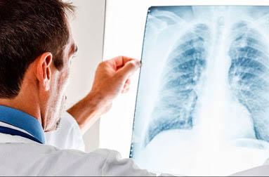 Как связаны болезни дыхательных путей и кишечник: неожиданные результаты исследований